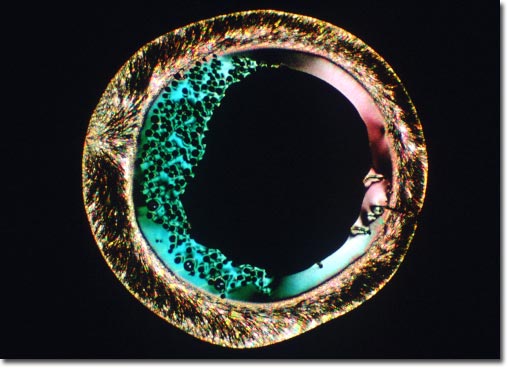 vitamin c photomicrograph